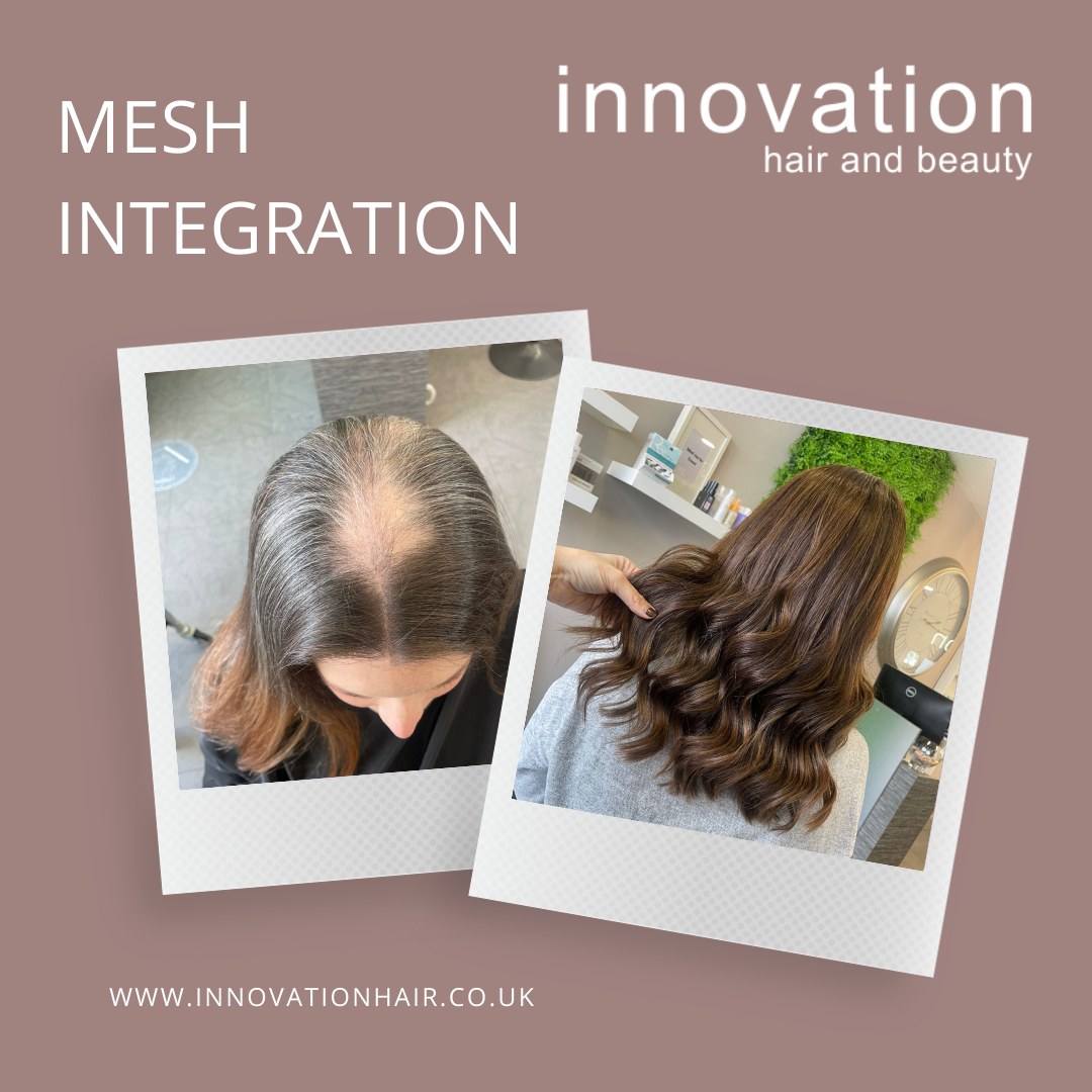 Hair replacement for women Hampshire